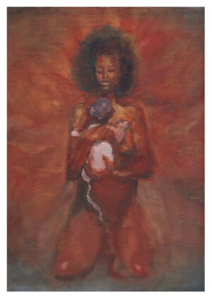 Delayed Cord Clamping - Print